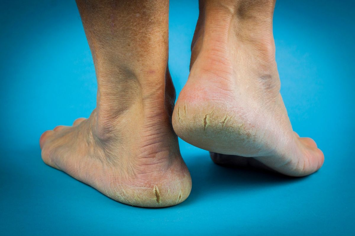 Pedicure Perfection: Foot Care Tips for Oil and Gas Worker Guyana